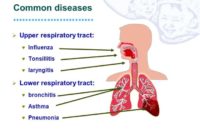 Infeksi Saluran Pernafasan Atas – Gejala Pengobatan Dan Perawatan