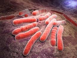 Penjelasan Lengkap Tuberkulosis Adalah - Pengertian TB Paru | Artikel TBC Terbaru