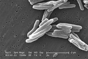 Gambar 2. Bakteri Mycobacterium tuberculosis, agen penyebab tuberkulosis