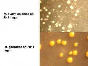 Mycobacterium avium dan gordonae