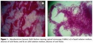 Infeksi Mycobacterium kansasii