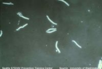 Jenis Bakteri Treponema - Penjelasan Singkat Dan Contohnya